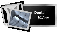 Dental Videos